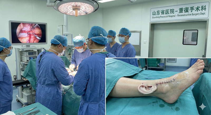 World's First: Ear Grafted to Foot in Pioneering Surgery